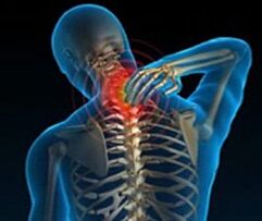 остеохондроза на шийните прешлени