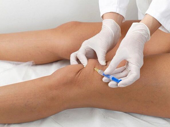 вътреставно инжектиране при артроза на коляното