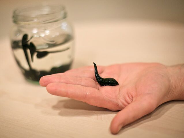 приложение за лечение на артроза на колянната става